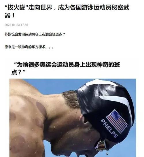 尝试东方神秘力量！北京男篮外援斯佩尔曼晒拔火罐视频